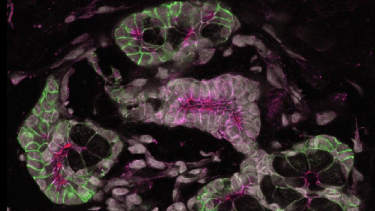 Image of salivary glad by the Knox Lab