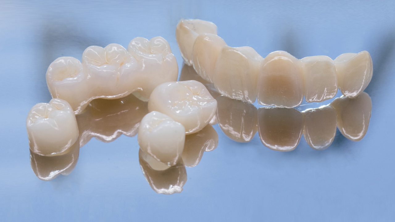 Metal-free ceramic dental crowns